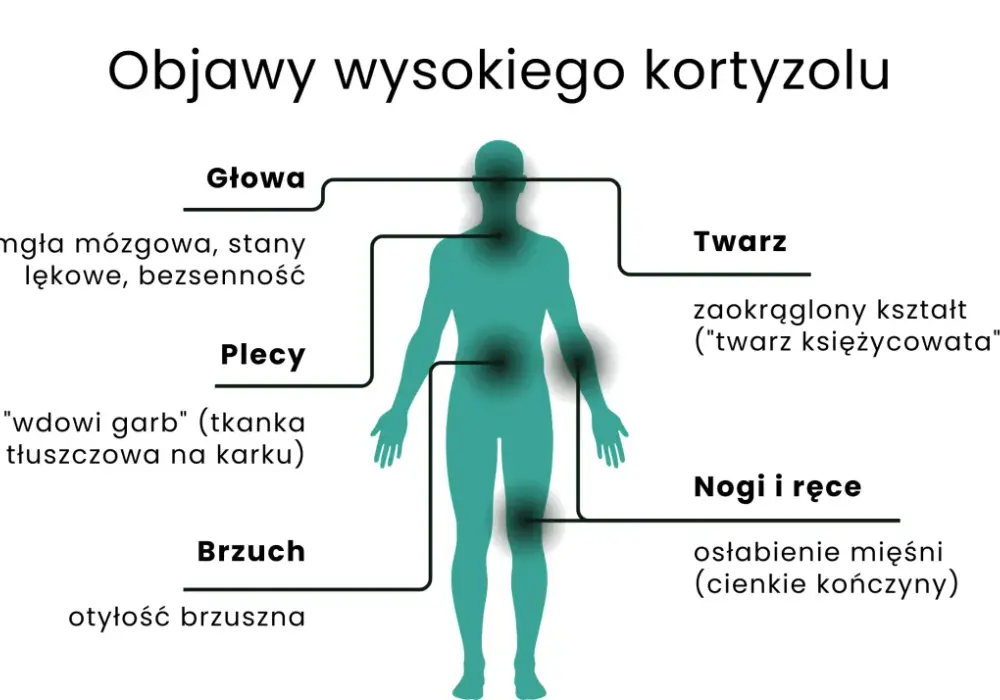 Zespół Cushinga - nadmiar kortyzolu? Objawy, leczenie, wsparcie