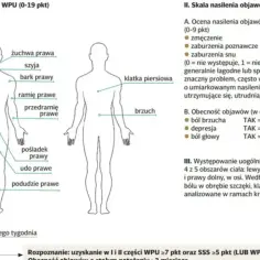 Schemat przedstawia lokalizację bólu w fibromialgii. Co to jest fibromialgia? To zespół objawów, m.in. bólu, zmęczenia, zaburzeń snu.