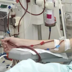 Ramię pacjenta podłączone do aparatury do dializy, z widocznymi cewnikami i maszynami medycznymi.
